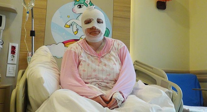 3 çocuk annesi düdüklü tencerenin patlamasıyla yaralandı