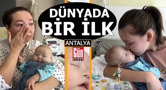 50 günlük bebeğe kalp ameliyatı ve karaciğer nakli