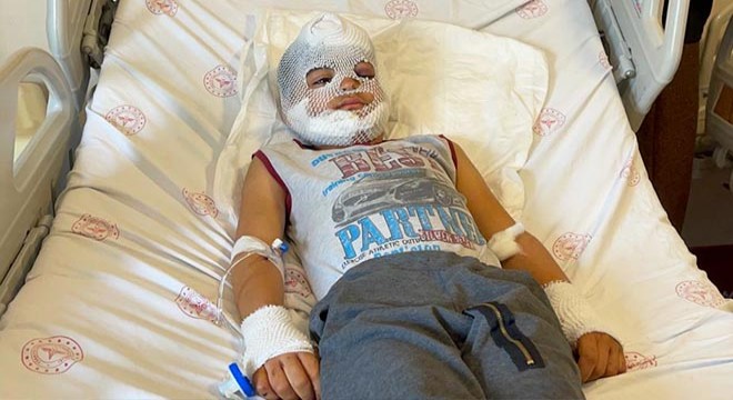 Ahmet'e saldıran köpeğin sahibi hakkında işlem başlatıldı