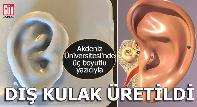 Akdeniz Üniversitesi Teknokent te yapay dokuyla dış kulak yapıldı