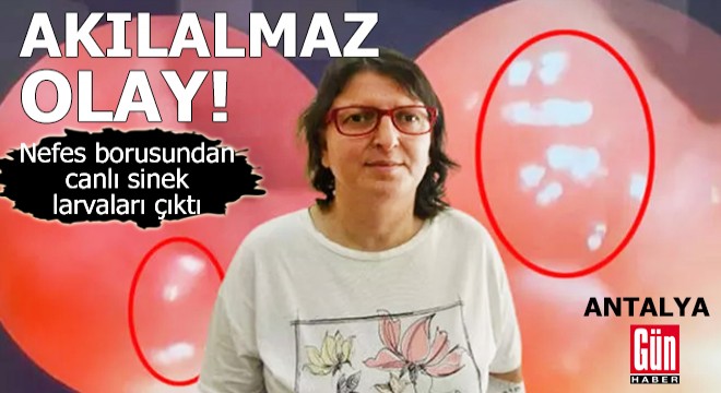 Akılalmaz olay! Nefes borusundan canlı sinek larvaları çıktı