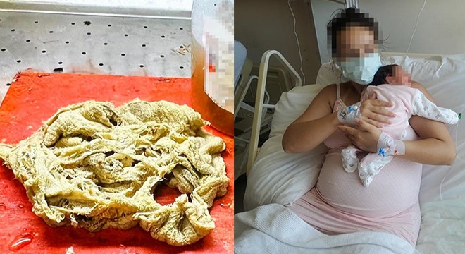 Antalya da doğumda unutulan gazlı bez ihmaline soruşturma izni