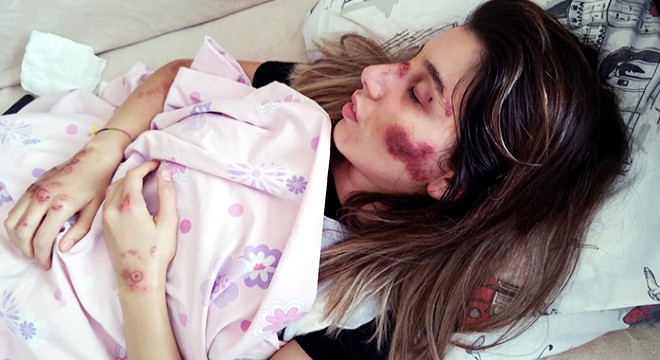 Araç çarpan Hatice'nin babası: Tek hayali insanları kurtarmaktı
