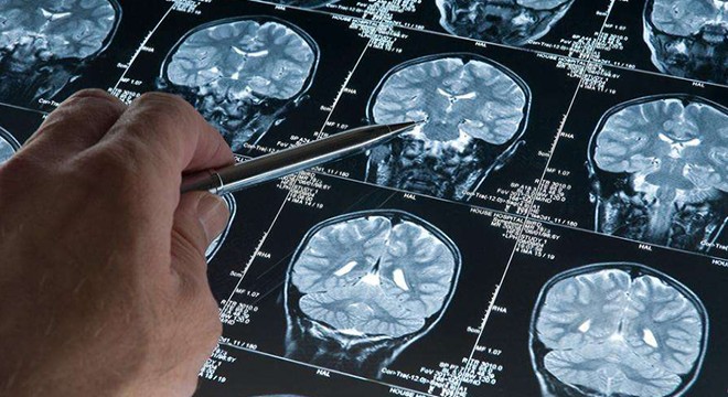 Araştırma: Derin uyku Alzheimer’ı yavaşlatıyor