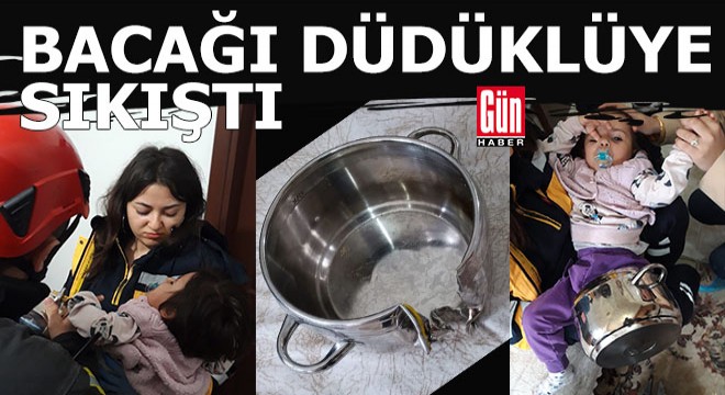 Bacağı düdüklüye sıkışan bebeği itfaiye kurtardı
