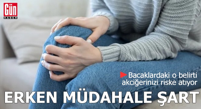 Bacaklardaki o belirti akciğerinizi riske atıyor