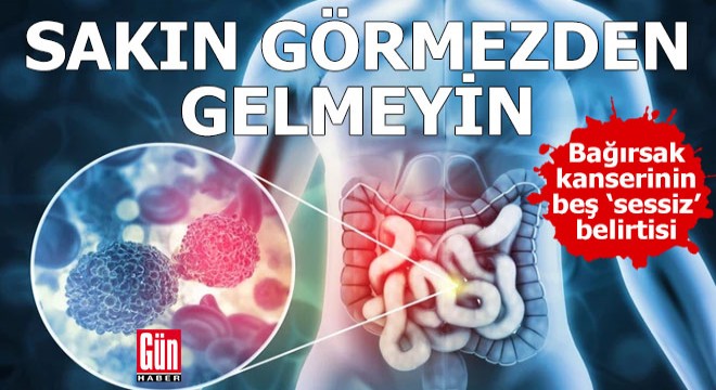 Bağırsak kanserinin beş ‘sessiz’ belirtisi