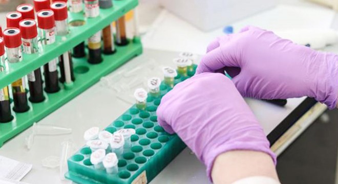 Bakan Koca: Evlilik öncesi SMA taraması bugün başlıyor