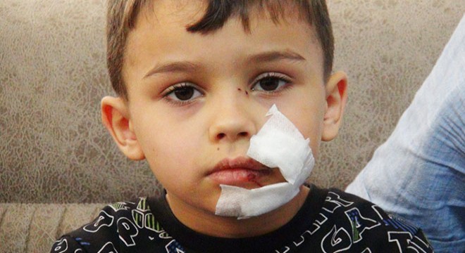 Başıboş köpeğin saldırdığı Yiğit'e 11 dikiş atıldı
