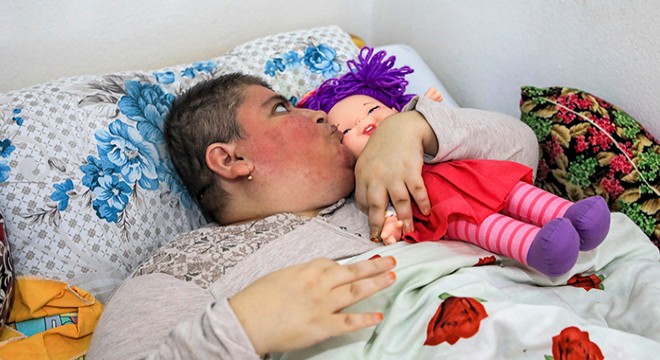 Felç olan Feride'nin tek isteği salıncakta sallanmak