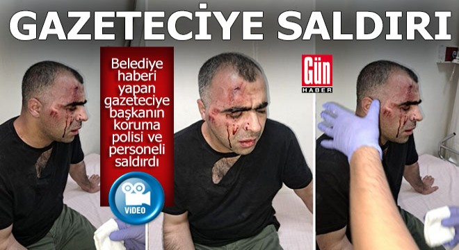 Belediye aleyhinde haber yapan gazeteci böyle saldırıya uğradı... İŞTE O ONLAR...