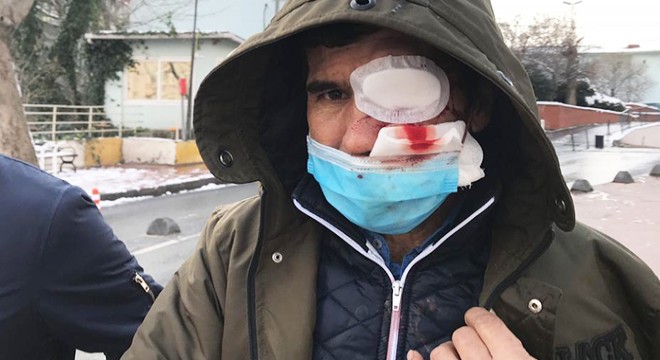 Binadan üzerine buz sarkıtı düşen kişi yaralandı