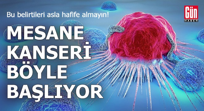 Bu belirtileri asla hafife almayın! Mesane kanseri böyle başlıyor