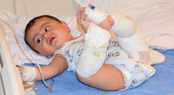 Çaydanlığı üzerine deviren İsmail bebek yaralandı