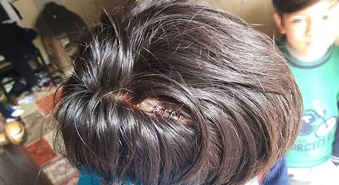 Cep telefonu kavgasında ağabeyini odunla kafasından yaraladı