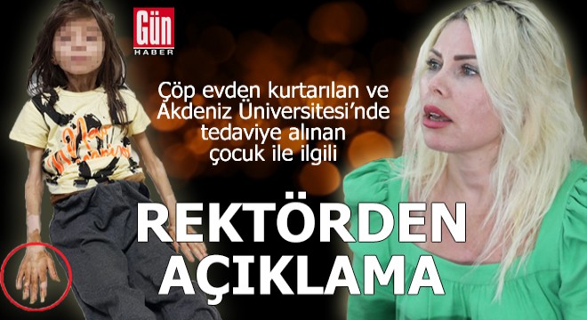 Çöp evden kurtarılan çocuk ile ilgili Rektör Özkan'dan açıklama