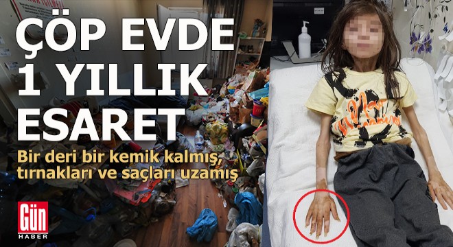 Çöp evde 1 yıldır odaya kilitli çocuk baygın bulundu