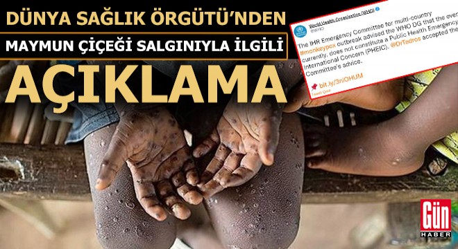 DSÖ den maymun çiçeği salgınıyla ilgili açıklama