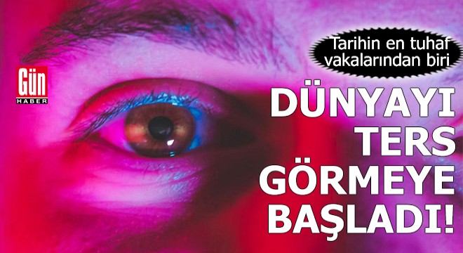 Dünyayı ters görmeye başladı!