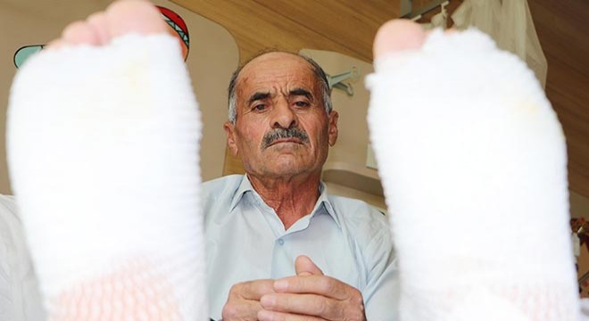 Elektrik akımına kapılınca ayak tabanları patladı