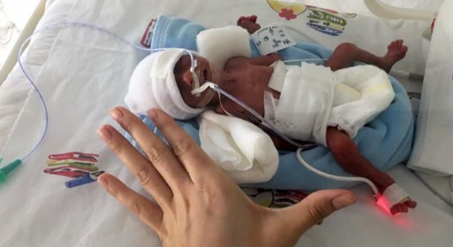 Erken doğan bebeklerin videosu, Avrupa'da ödül aldı