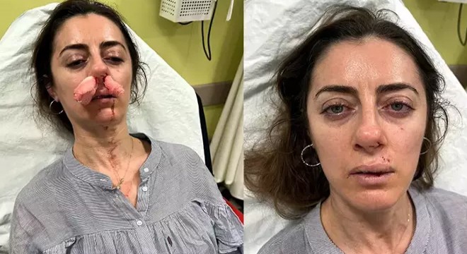Eşimin sevgilisi sandım diyerek araç kapısıyla saldırdı