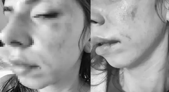Eşini darbeden şüpheli tutuklandı