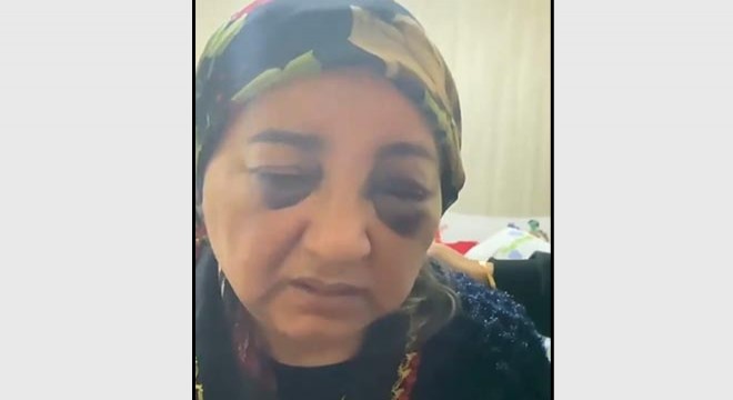 Eşini dövüp aç bırakan koca tutuklandı