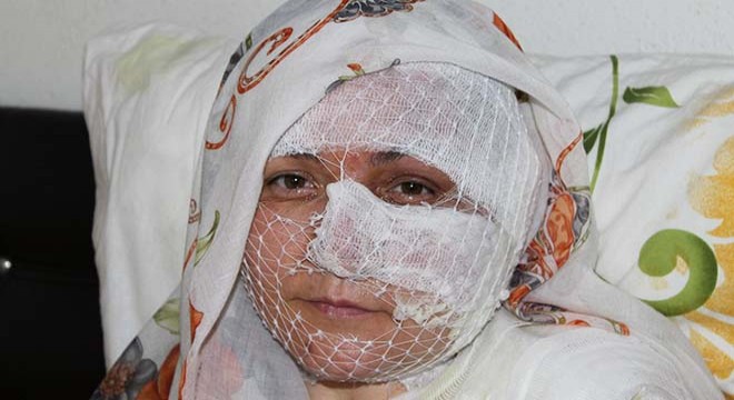 Eşinin kızgın yağ ile yaktığı kadın: Ölmek istemiyorum