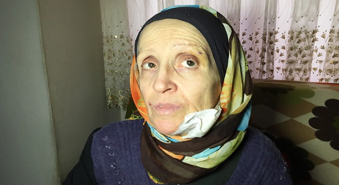 Eşinin yaktığı kadın: Yapma diye yalvardım