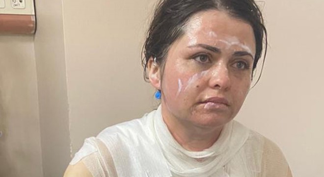 Eski eşe kimyasal maddeli saldırı