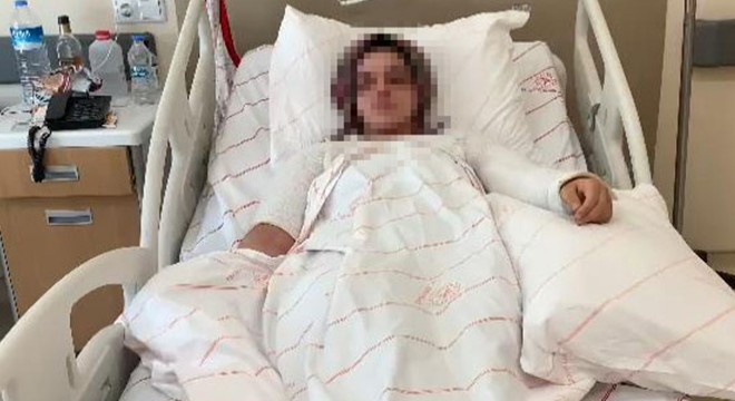 Eski nişanlısının yüzüne kimyasal atan sanık: Susturmak için yaptım