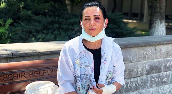 Eski sevgilisinin takside dövdüğü Habibe: 20 dakika boyunca darbetti