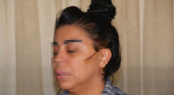 Eski sevgilisinin yüzünü ustura ile kesen şüpheli, tutuklandı