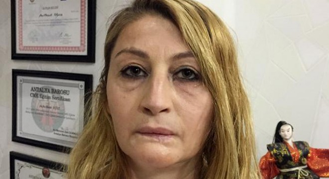 Estetik mağdurları önyargıdan çekinerek, öne çıkamıyorlar'
