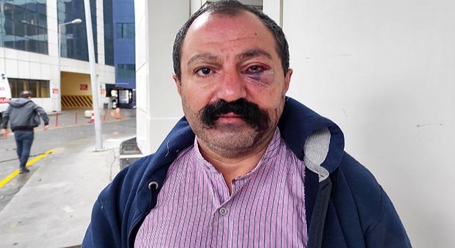 Ev sahibinin kardeşinden kiracıya saldırı iddiası
