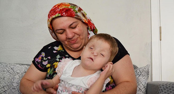 Fraser sendromlu Sevgi Hira, anne sevgisiyle yaşama tutunuyor