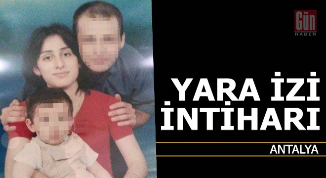 Geçmeyen yara izi intihar ettirdi
