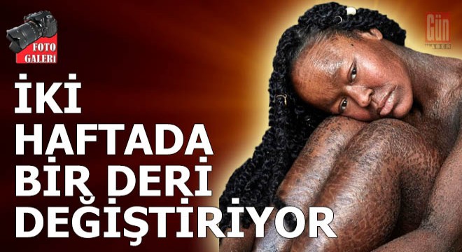 Genç model, iki haftada bir deri değiştiriyor!
