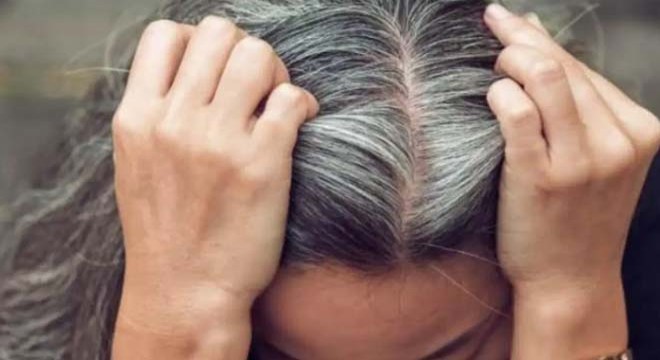 Gençlikte saç beyazlamasının nedeni ortaya çıktı