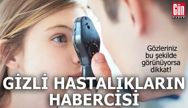 Gözleriniz gizli hastalıkların habercisi!