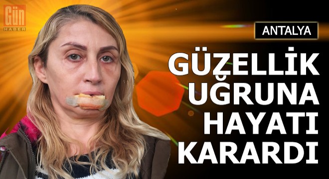Güzellik uğruna hayatı karardı
