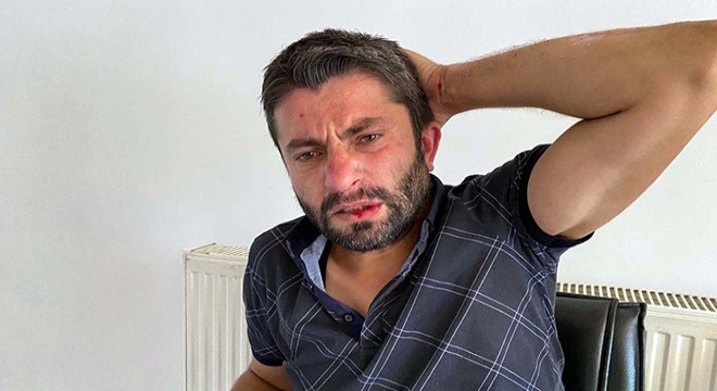 Haber takibindeki DHA muhabirine saldırı