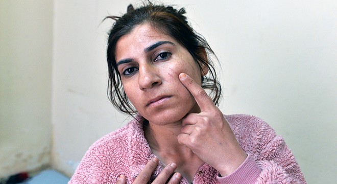 Hayatı kabusa dönen Ceylan: Yaşamak istiyorum