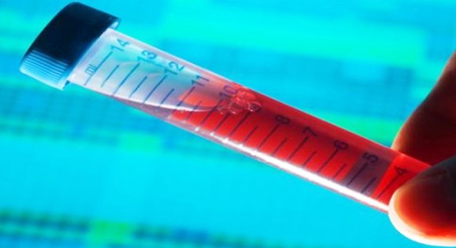 Hiv Testi Hakkında Genel Bilgiler