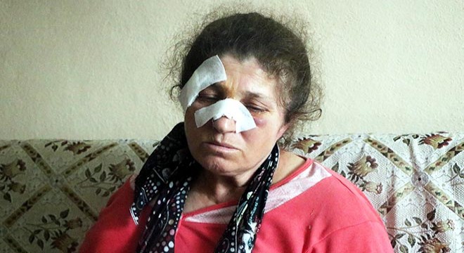 Husumetli olduğu baba-oğulun baltalı saldırısında yaralandı