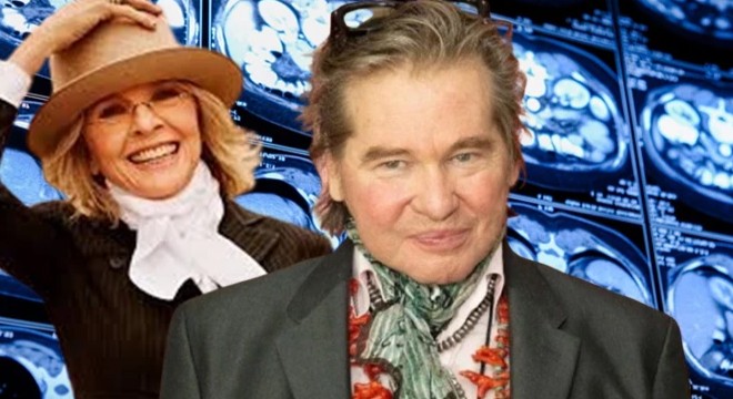 İki ünlü isim hayatını kaybetti: Gripten sonra gelen tehlike