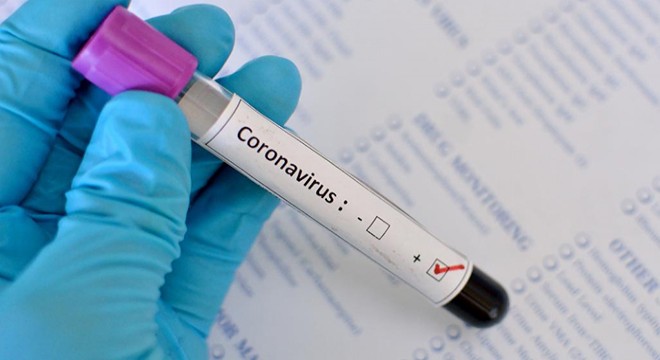 İran’da koronavirüsten can kaybı 4 bin 869’a yükseldi