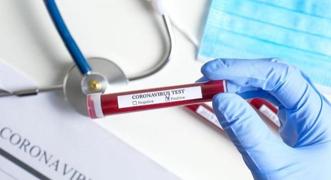 İstanbul Havalimanı'nda 30 bin yolcuya koronavirüs testi yapıldı