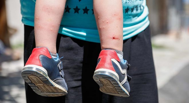 İstanbul'da 'Aedes' tehdidi